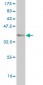 QPCT Antibody (monoclonal) (M01)